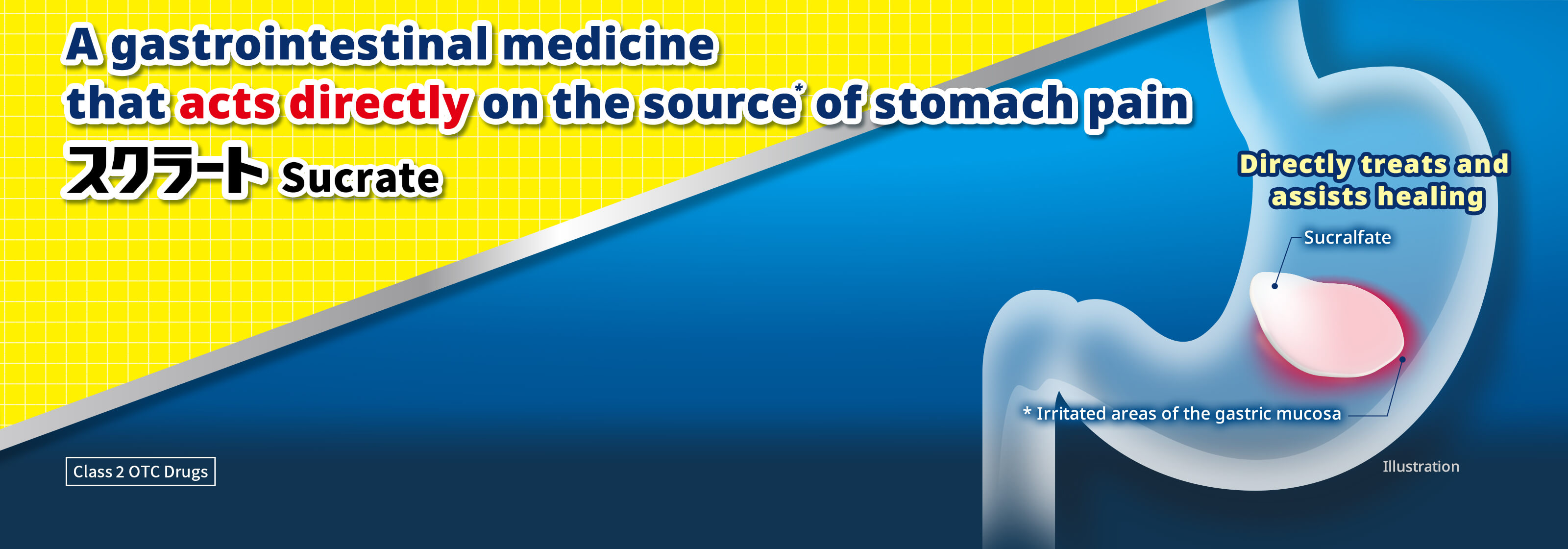 A gastrointestinal medicine that acts directly on the source of stomach pain スクラート Sucrate Class 2 OTC Drugs