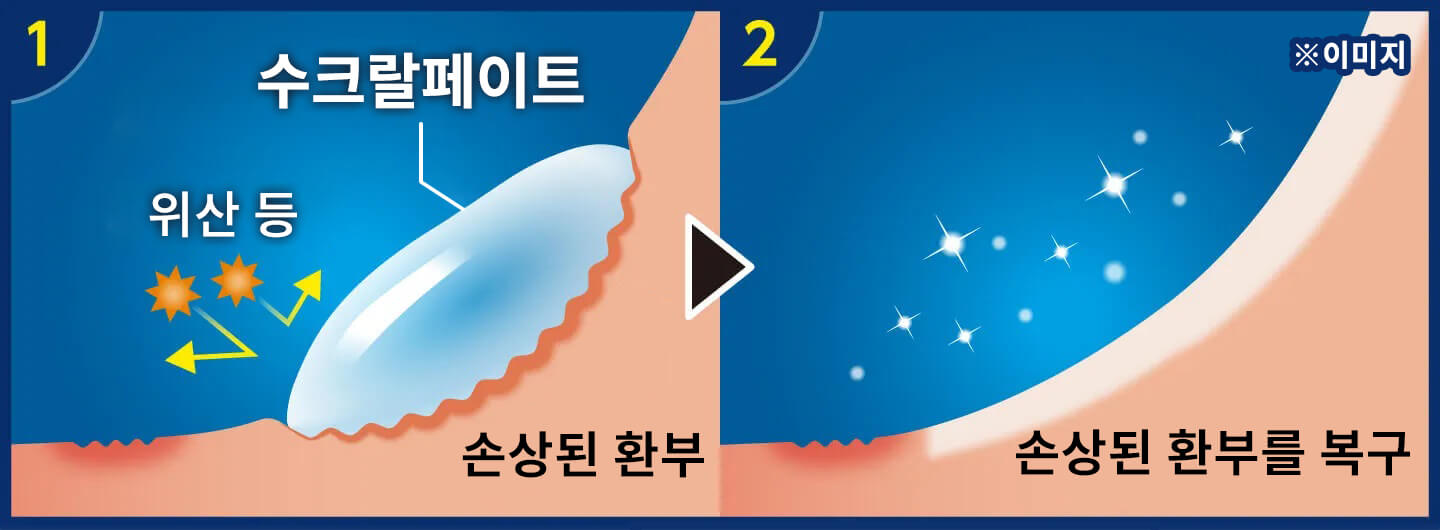 손상된 환부 손상된 환부를 복구